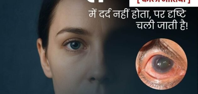 Kala Motia Treatment in India
